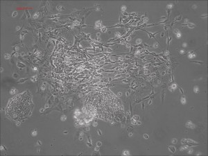 Neurons appear from precursor cells shortly after the rosette stage